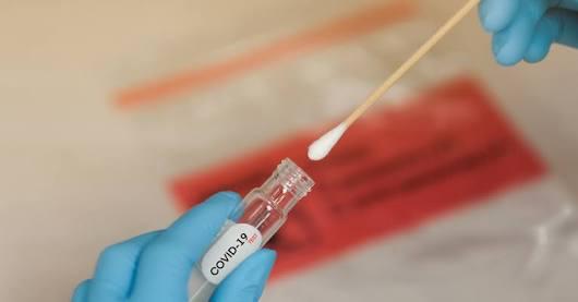Varre-Sai registrou mais 42 casos de Covid-19 na Testagem Ampliada.