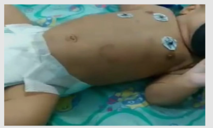 São Fidélis : Bebê corre risco de vida após ser agredido pelo pai.