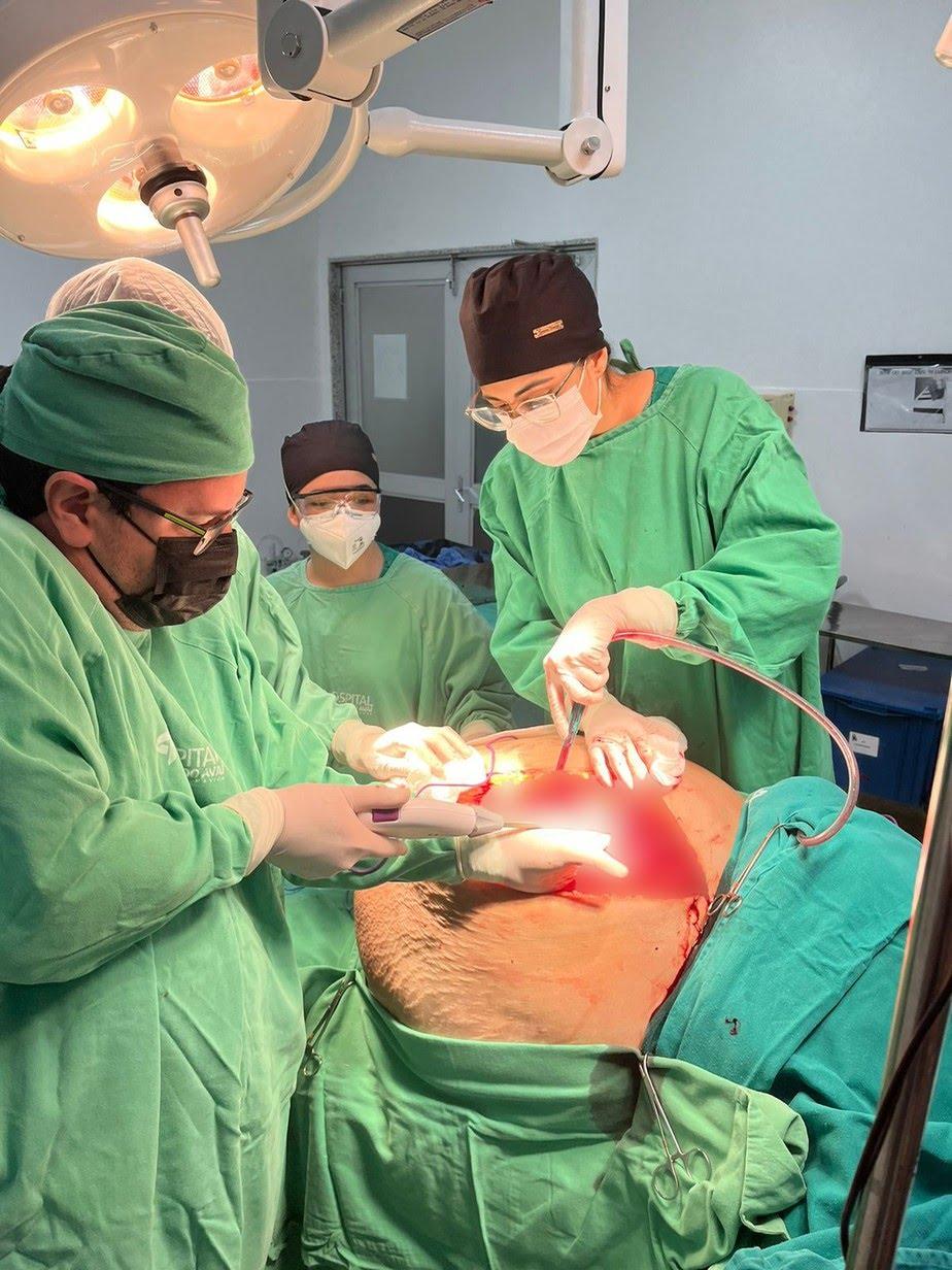 Médico retira tumor de 46 kg da barriga de paciente em Itaperuna