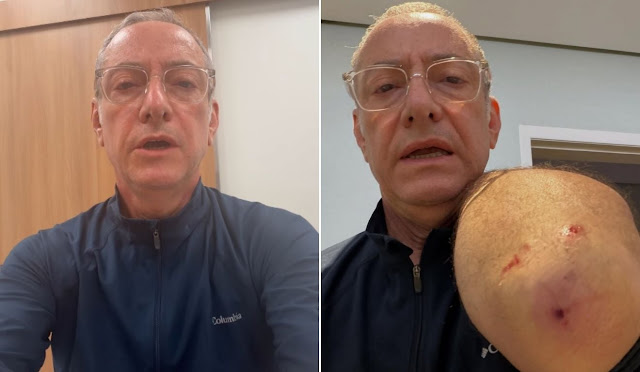 Repórter da TV Globo é atacado por pitbull e desabafa: 