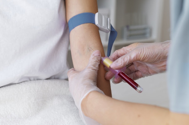 Coleta de exame de sangue em casa: como se preparar para o atendimento?