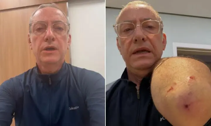 Repórter da TV Globo é atacado por pitbull e desabafa: 